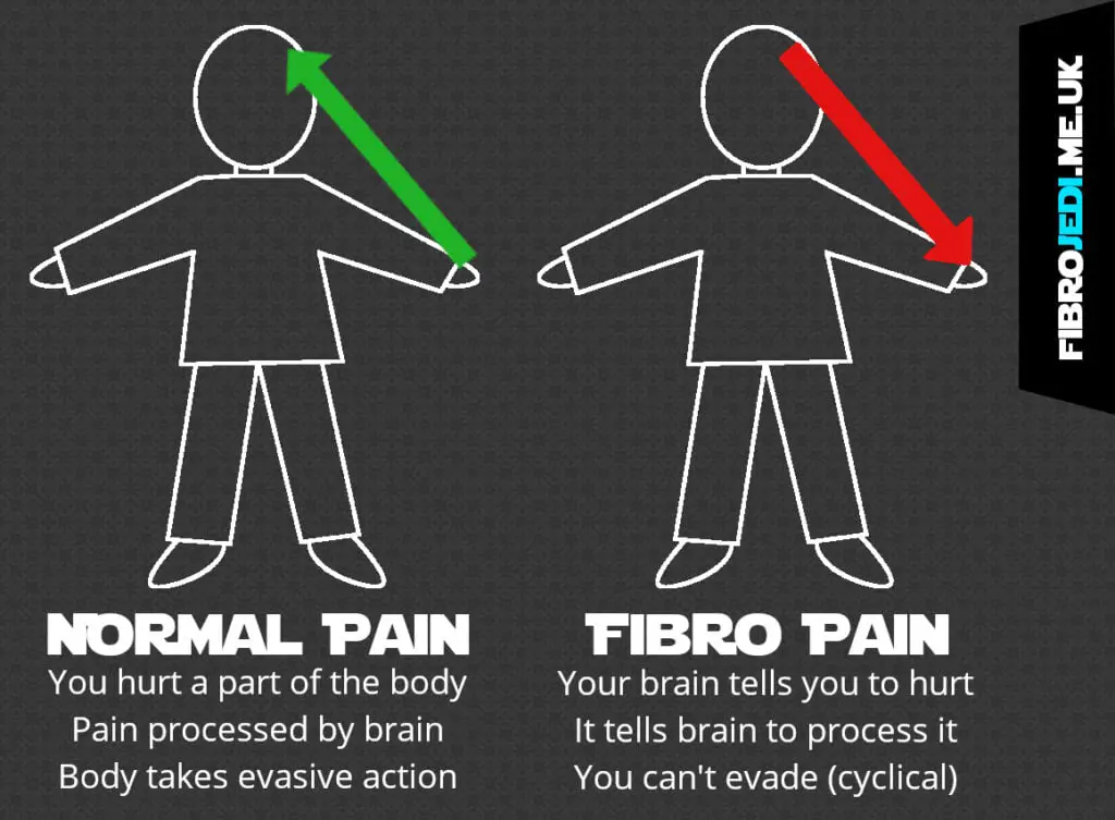 Normal Pain Signals vs Fibromyalgia Pain Signals